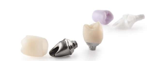 Learn more about your dental health by reading Cement Retained Implant Restorations in Arlington Heights, IL. Dental Clinique welcomes new patients in their dental office in Arlington Heights, IL. Dental Clinique Blog in Arlington Heights, IL
