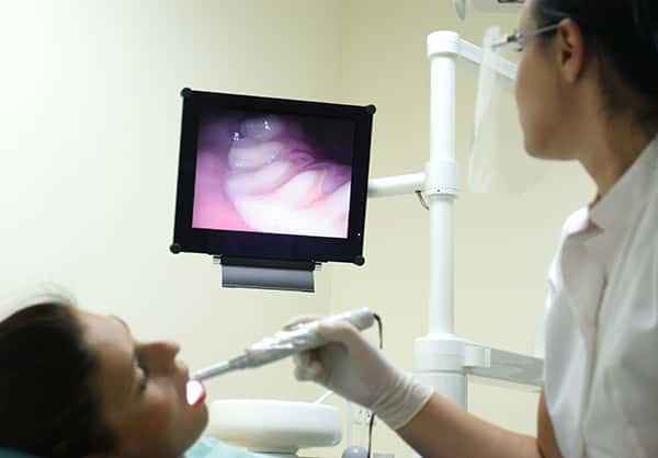 Intraoral Camera in Arlington Heights, IL