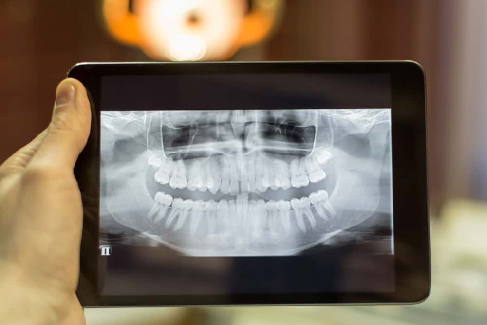 Dr. Madalina Ivan, recommended dentist near 60004, uses digital x-rays in Arlington Heights, IL to enhance the health and wellness of their patients. Dental Clinique welcomes new patients at their dental office in Arlington Heights, IL. Digital X-rays in Arlington Heights, IL