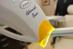 General and cosmetic dentist in Arlington Heights IL. Get a brighter smile than ever before with teeth whitening and dental implants near 60004. Teeth Whitening in Arlington Heights IL